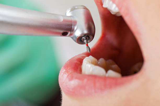 Best Emergency TMJ Treatment in Mooresville, NC